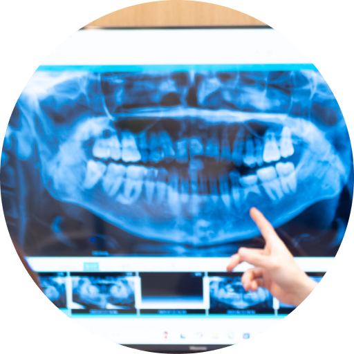 口腔内写真の撮影の様子